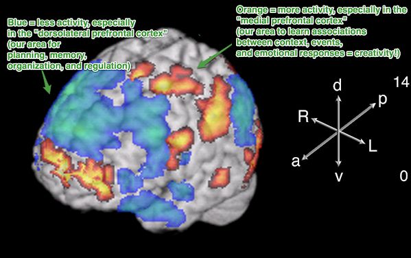 Brain activity of freestyle rappers