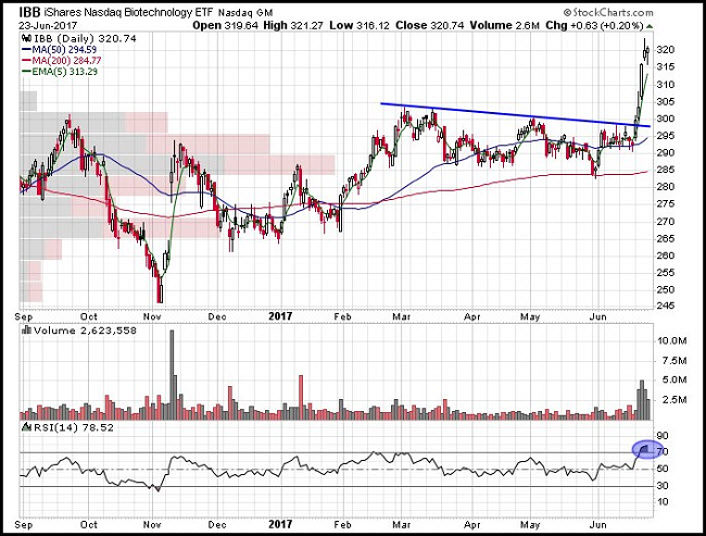 IBB Chart